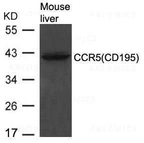 Anti-CCR5(CD195)