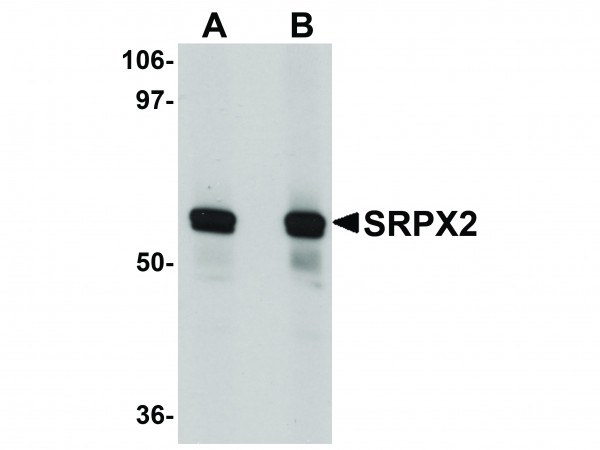 Anti-SRPX2