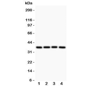 Anti-MCL1