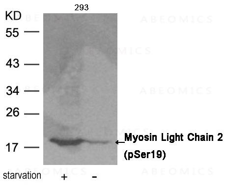Anti-phospho-Myosin Light Chain 2 (Ser19)