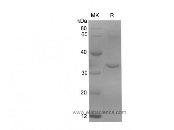 SARS-CoV-2 (2019-nCoV) Papain-Like Protease Protein , recombinant