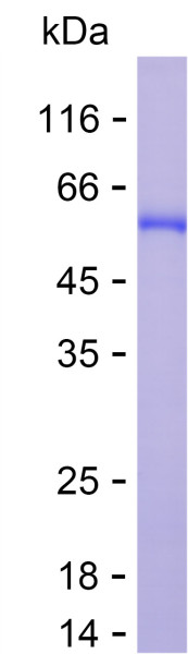 Recombinant Human Retinoic Acid Receptor beta Protein