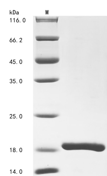 Gamma-aminobutyric acid receptor-associated protein (GABARAP), human, recombinant