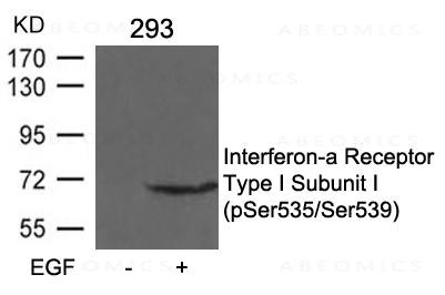 Anti-Interferon-a Receptor Type I Subunit I (phospho-Ser535/Ser539)