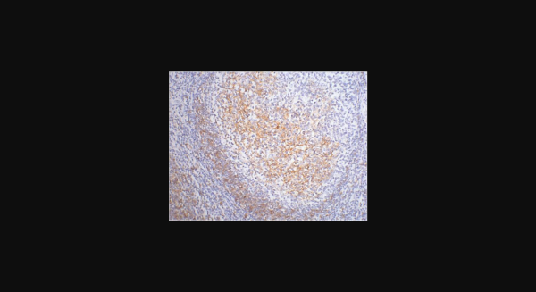 Anti-CD23, monoclonal