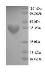 Malonyl CoA-acyl carrier protein transacylase (fabD), Staphylococcus aureus, recombinant