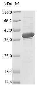 Ribonuclease H1 (RNASEH1), human, recombinant
