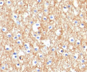 Anti-Drebrin 1, clone DRBP1-1