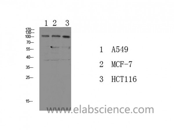 Anti-Phospho-Na+/K+-ATPase alpha1 (Tyr260)