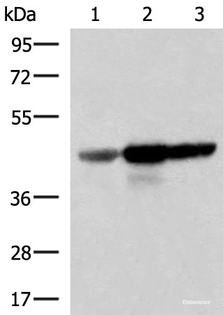 Anti-FDFT1