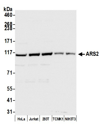 Anti-ARS2