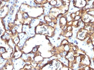 Anti-CD34 (Hematopoietic Stem Cell &amp; Endothelial Marker)(Clone: HPCA1/1171)