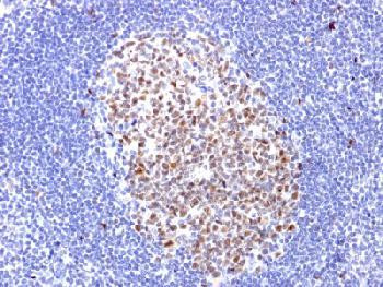 Anti-Bcl-6 (Follicular Lymphoma Marker) Recombinant Rabbit Monoclonal Antibody (clone:BCL6/1951R)