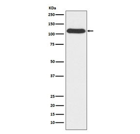 Anti-OGT / O-GlcNAc transferase subunit p110, clone AEDG-15