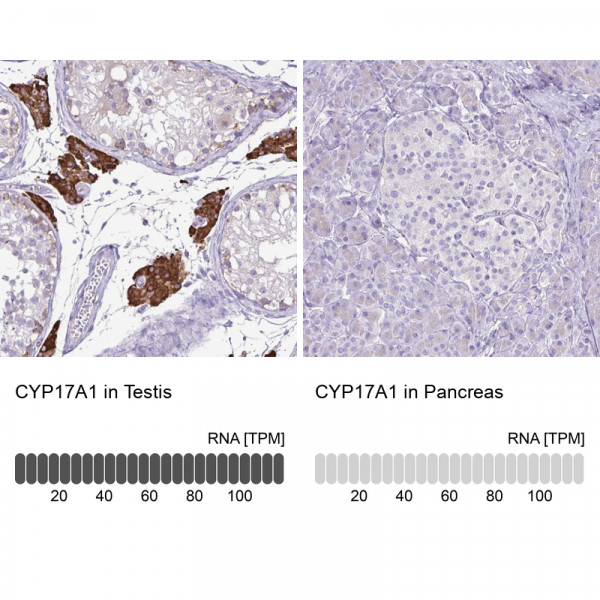 Anti-CYP17A1