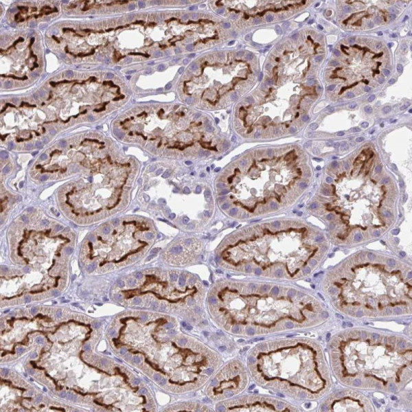 Anti-TOR1AIP2