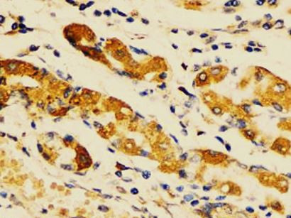 Anti-OGN / Osteoglycin