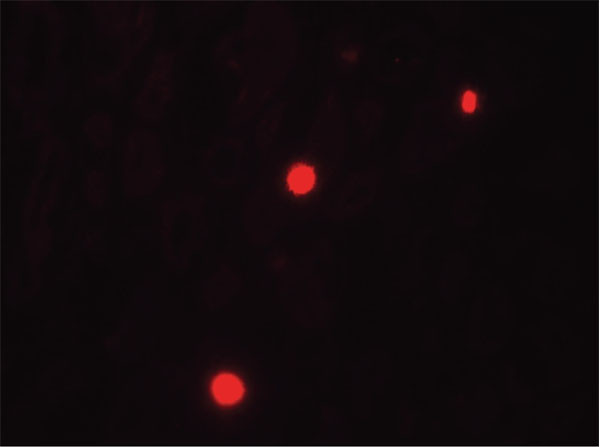 Anti-NOX1