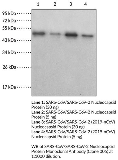 Anti-SARS-CoV/SARS-CoV-2 Nucleocapsid Protein (Clone 005)