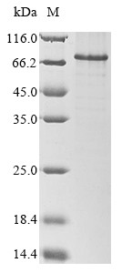 Interferon regulatory factor 1 (IRF1), human, recombinant