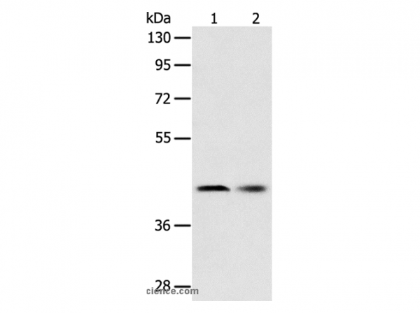 Anti-SERPINA5