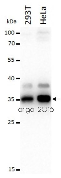 Anti-S6 Ribosomal Protein