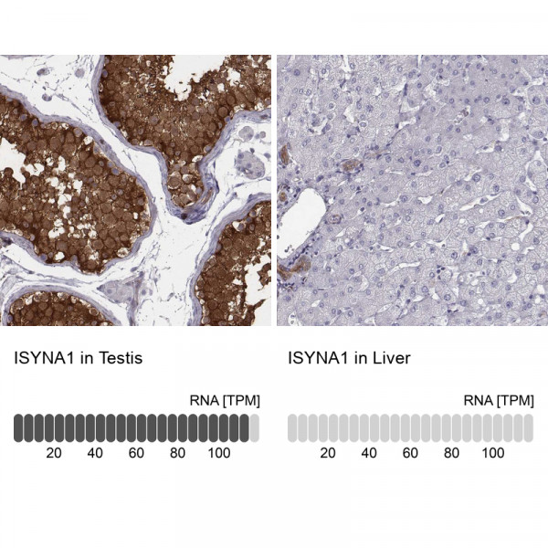Anti-ISYNA1