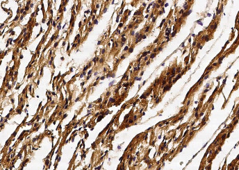 Anti-GSTM2 Monoclonal Recombinant Antibody