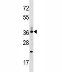 Anti-CD68