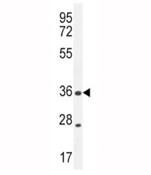 Anti-XCR1