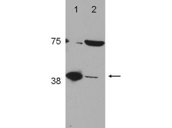 Anti-POLB (DNA polymerase beta)