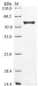 Dihydrolipoyllysine-residue succinyltransferase component of 2-oxoglutarate dehydrogenase complex (s