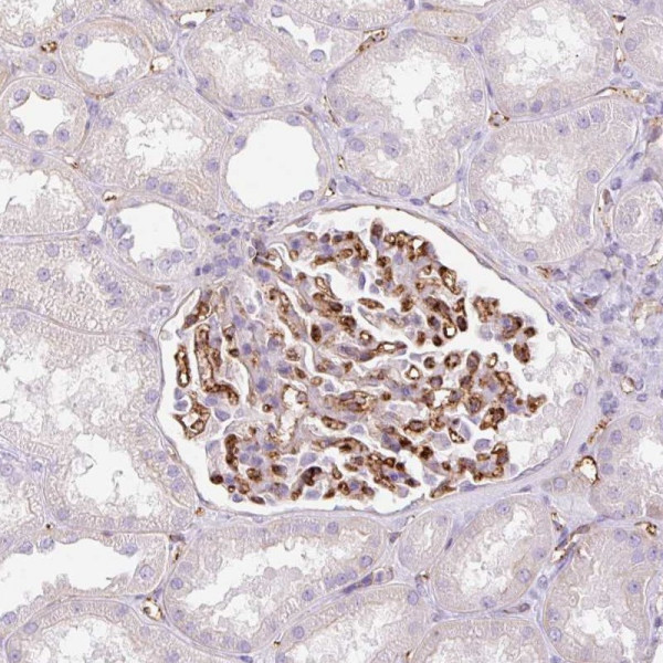 Anti-EHD3