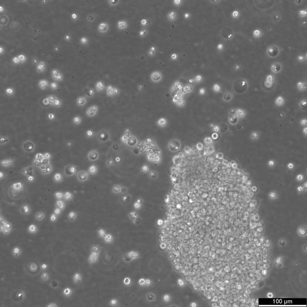 NB-4 Cells