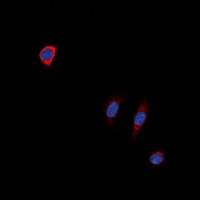 Anti-Neurotensin Receptor 1