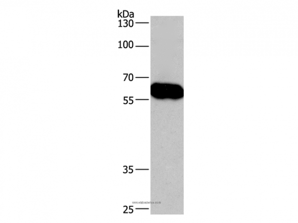 Anti-CORO1C