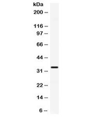 Anti-IP10 / CXCL10
