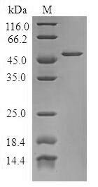 Tumor protein D53 (TPD52L1), human, recombinant