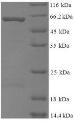 Gag polyprotein (gag), partial, Moloney murine leukemia virus, recombinant