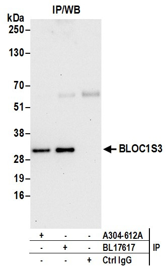 Anti-BLOC1S3