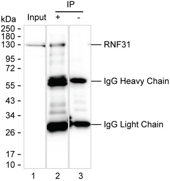 Anti-RNF31 Magnetic Beads