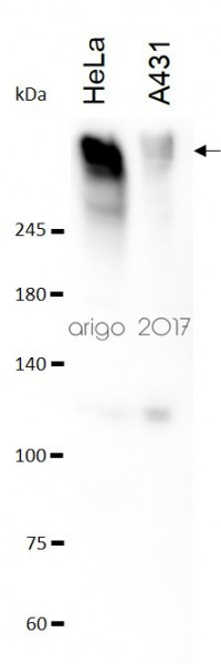 Anti-MUC16 / CA125, clone SQab1724