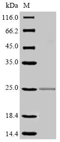 Low affinity immunoglobulin gamma Fc region receptor III (Fcgr3), partial, mouse, recombinant