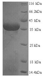 Squamous cell carcinoma antigen recognized by T-cells 3 (SART3), partial, human, recombinant