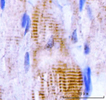 Anti-M Cadherin / CDH15 / CDH14