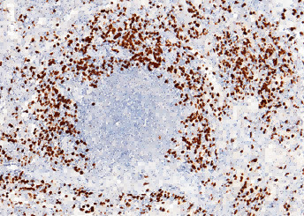 Anti-S100P Monoclonal Recombinant Antibody