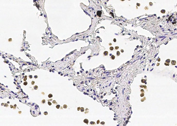 Anti-COMMD9 Monoclonal Recombinant Antibody