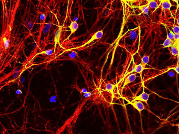 Anti-Tau, clone 5B10