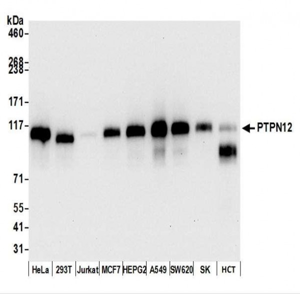 Anti-PTPN12 Recombinant Monoclonal