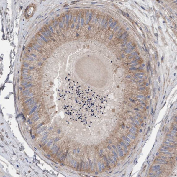 Anti-CDK5RAP3